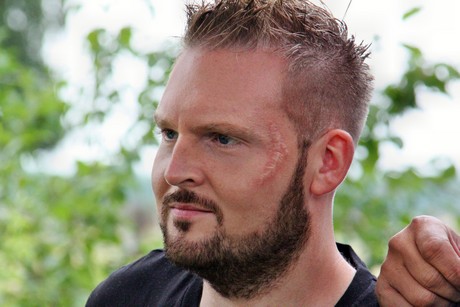 axel-stein