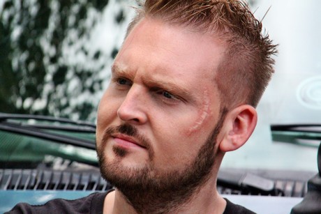 axel-stein