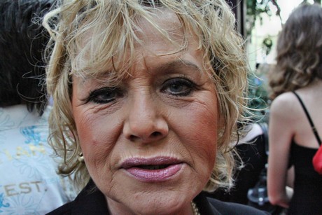 csd